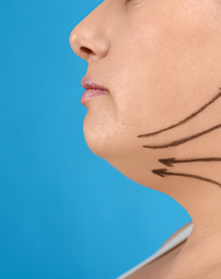 Double Chin Treatment