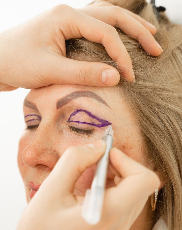 Eyelid Surgery