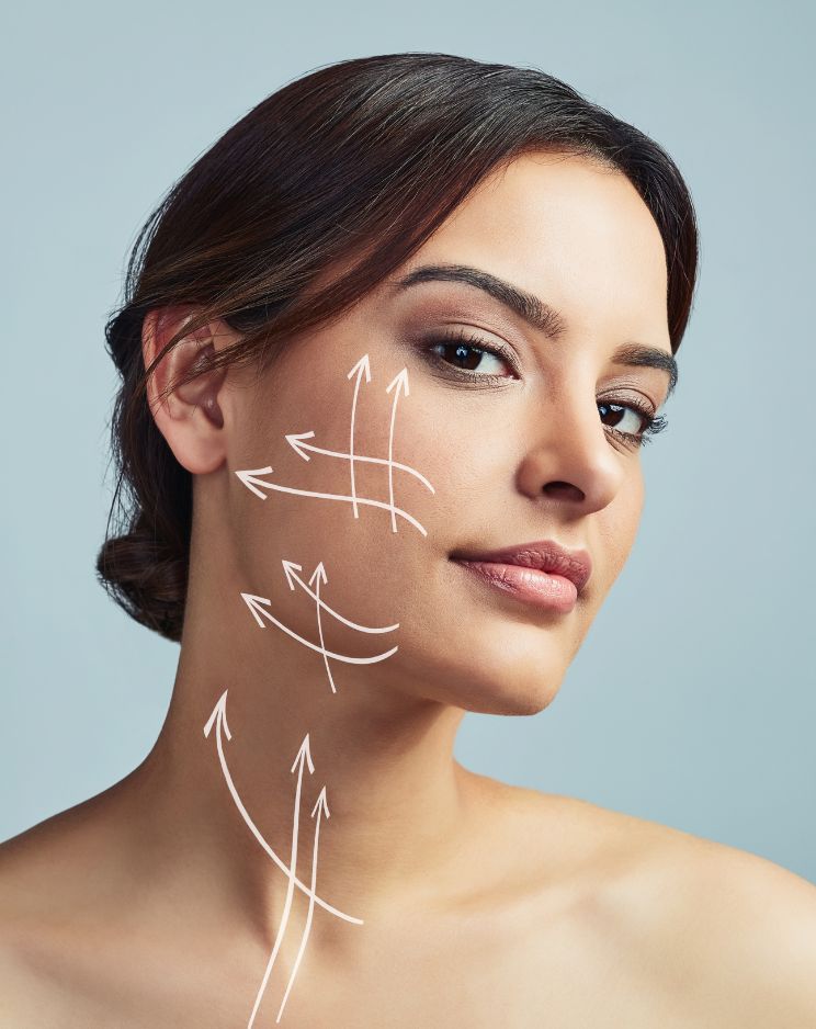 Facelift