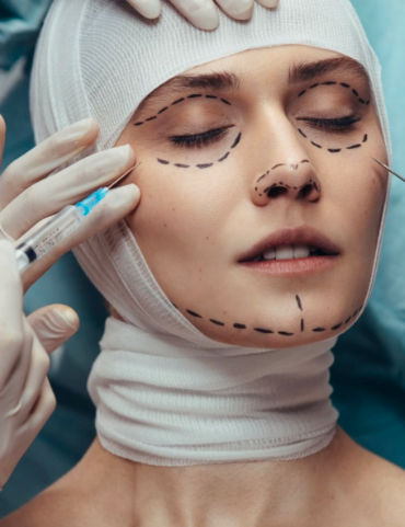 Facial Feminisation Surgery