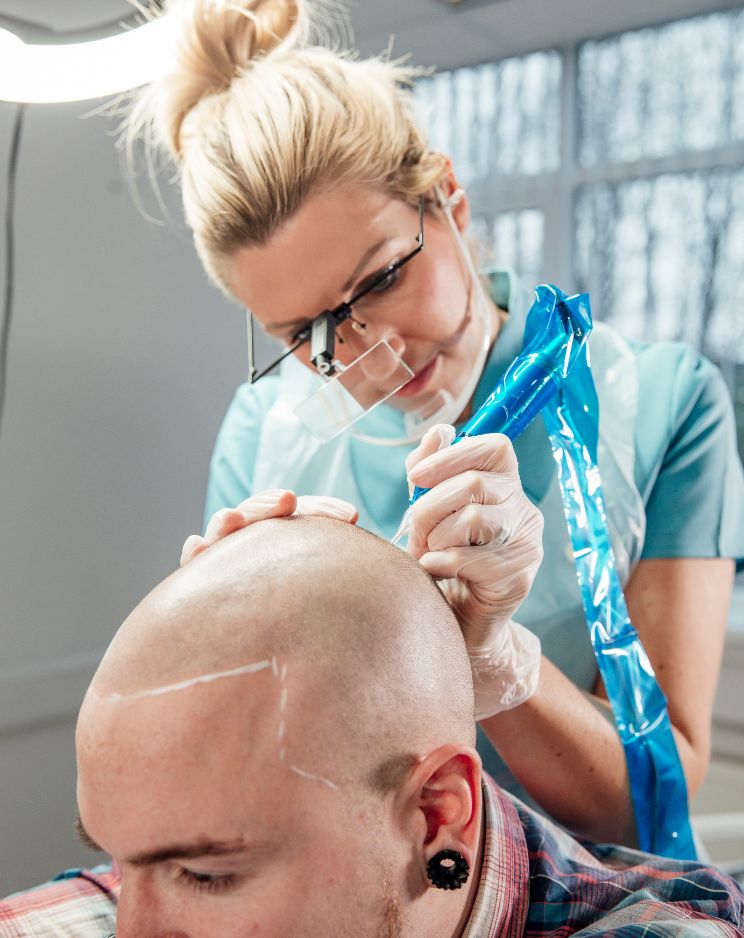 Scalp Micropigmentation