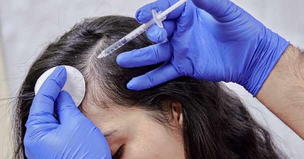 Cost of Mesotherapy Treatment in Mumbai
