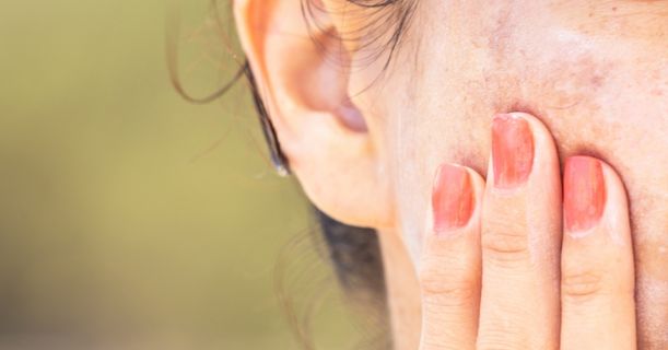 Cost of Pigmentation Treatment in Mumbai