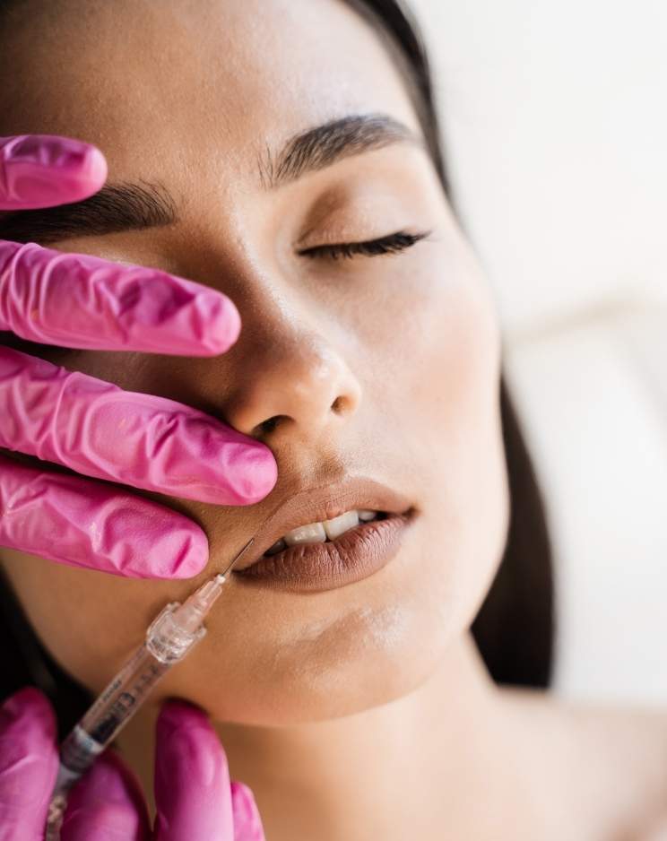 Why Choose Professional Dermal Filler Treatment