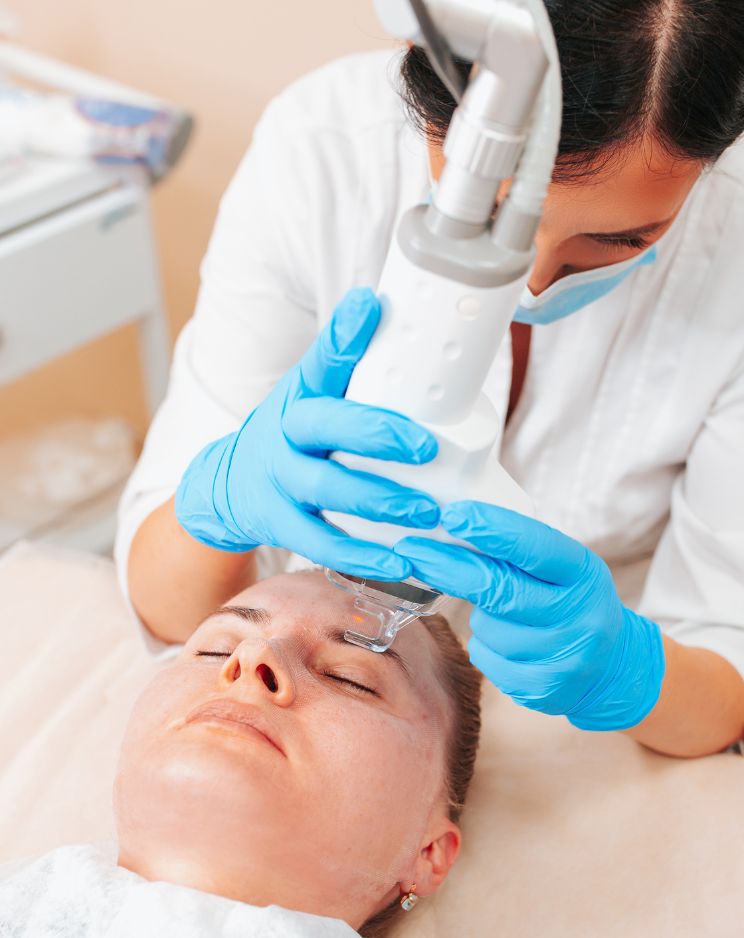 Why Choose Professional Laser Resurfacing