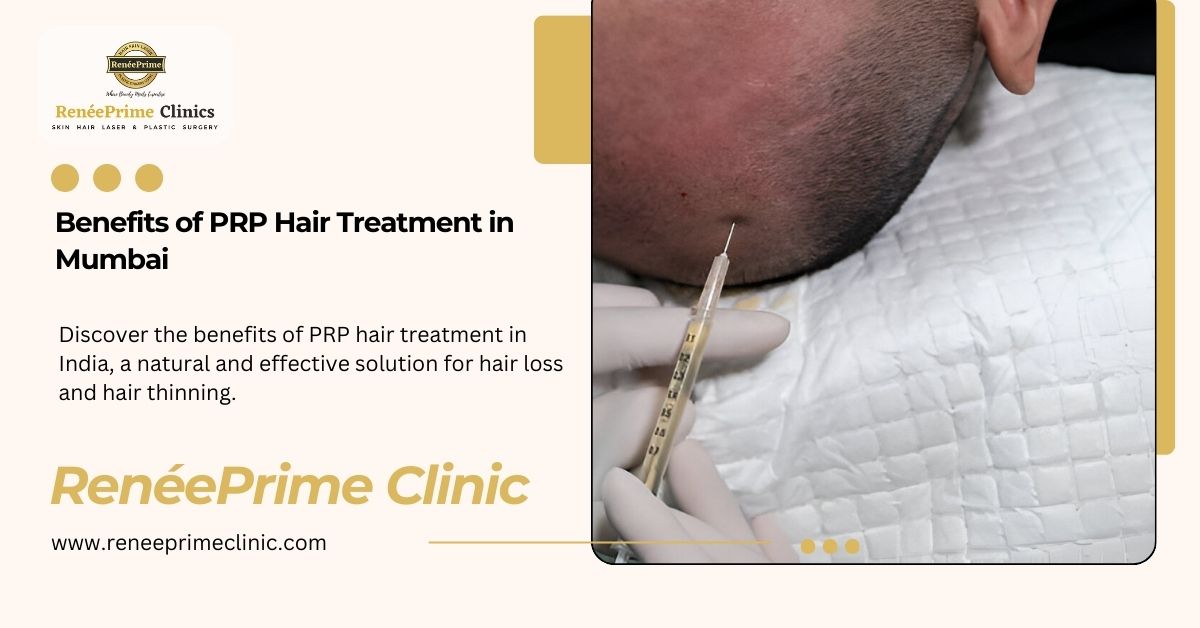 Benefits of PRP Hair Treatment in Mumbai