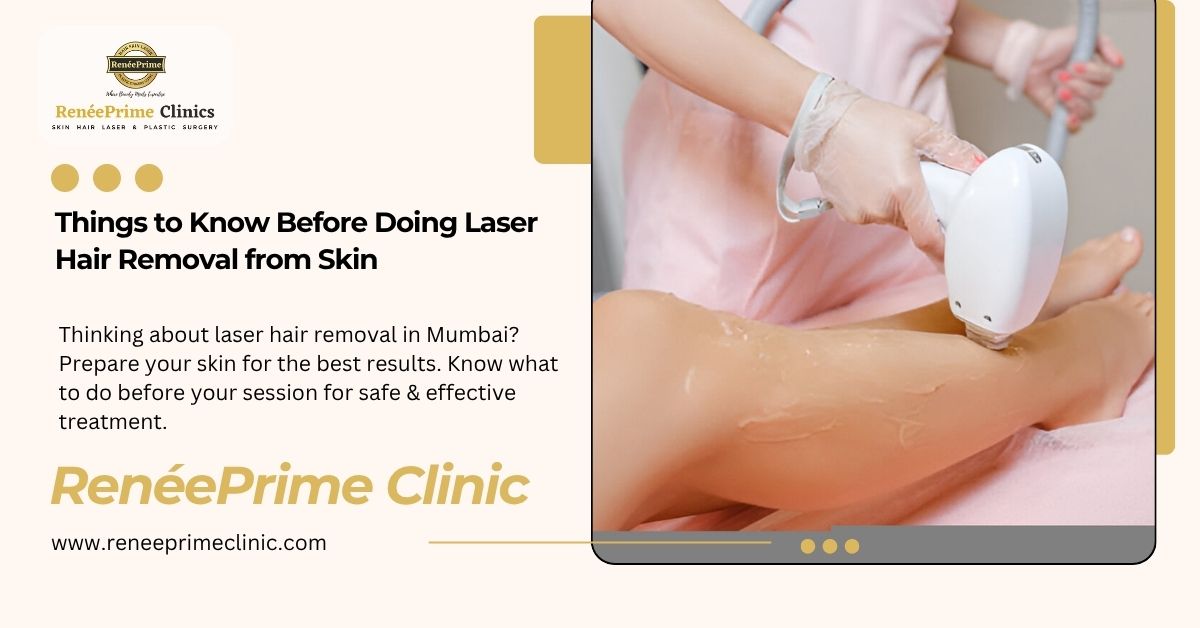 Things to Know Before Doing Laser Hair Removal from Skin
