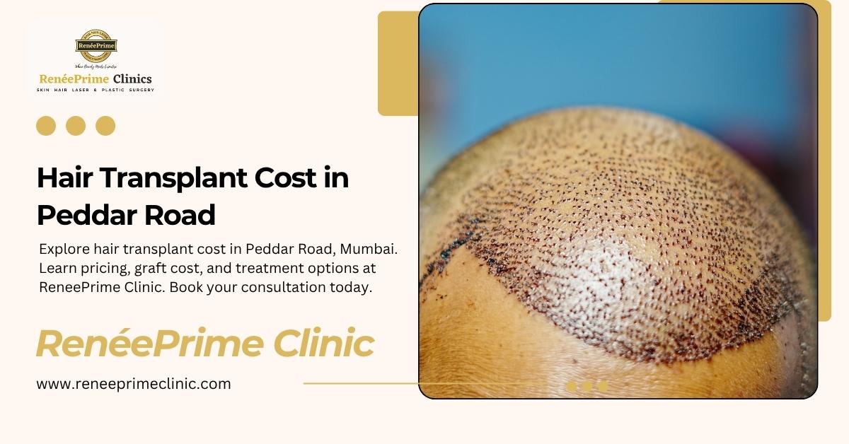 Hair Transplant Cost in Peddar Road