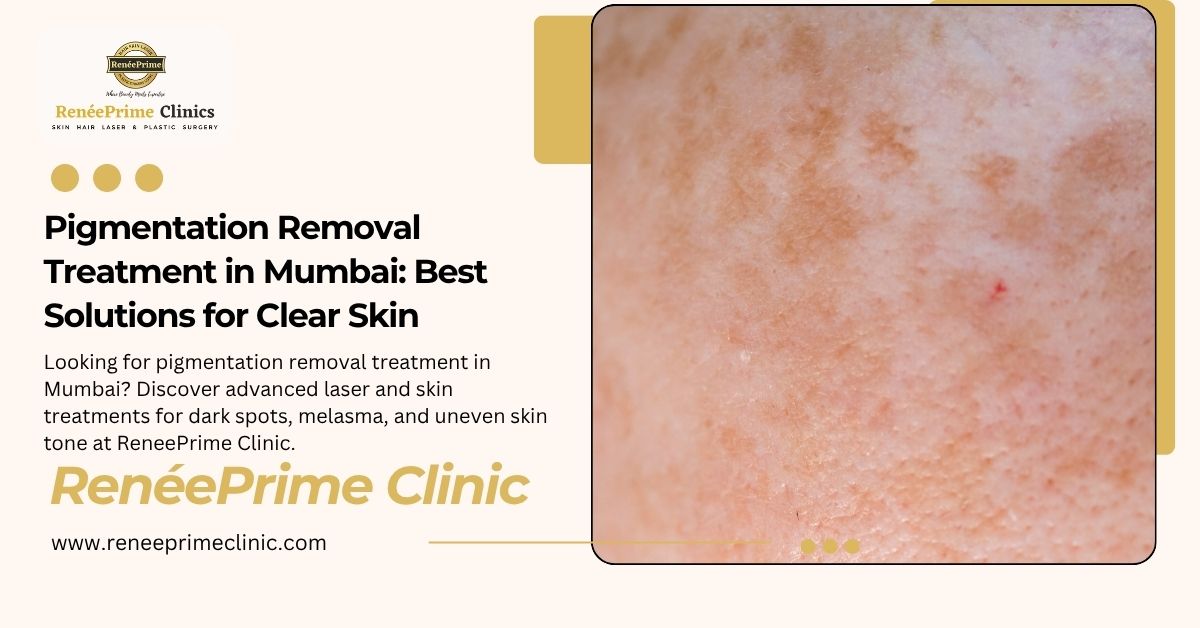 Pigmentation Removal Treatment in Mumbai Best Solutions for Clear Skin