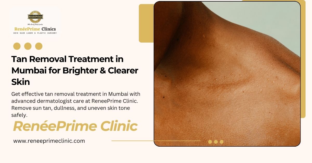 Tan Removal Treatment in Mumbai for Brighter & Clearer Skin