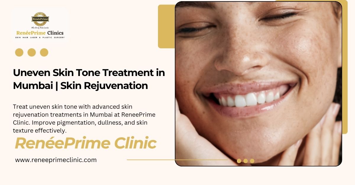 Uneven Skin Tone Treatment in Mumbai for Smooth Glowing Skin