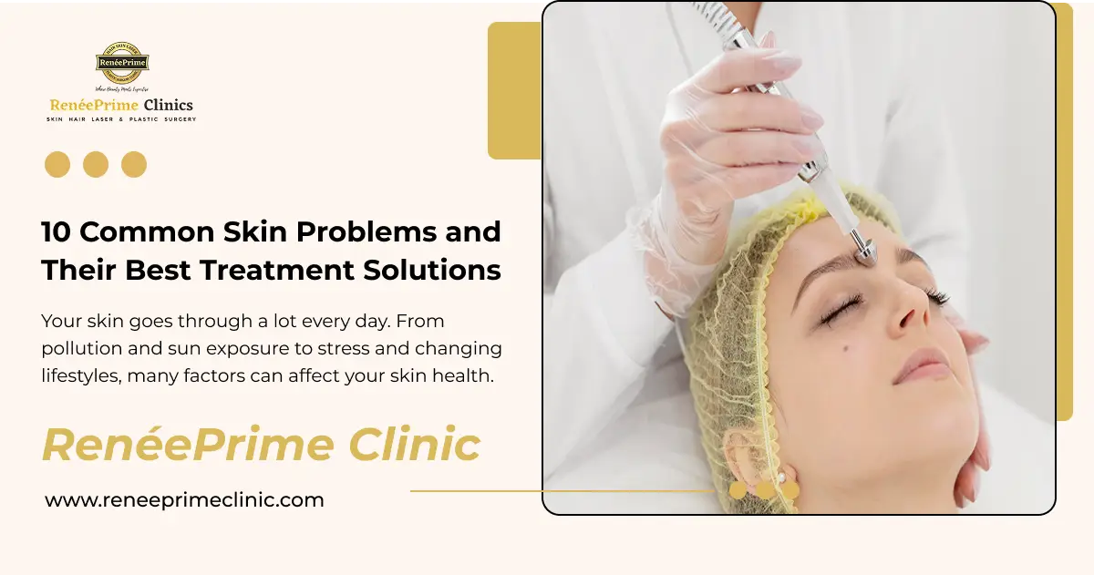 10 Common Skin Problems and Their Best Treatment Solutions
